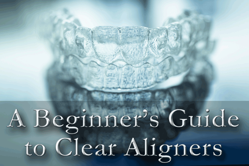 Beginner’s Guide to Clear Aligners