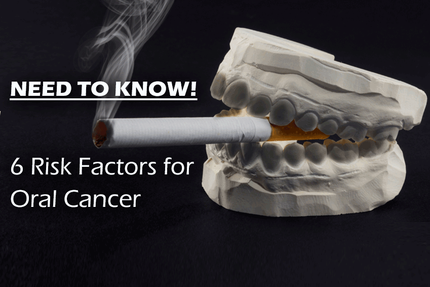 Need to Know! 6 Risk Factors for Oral Cancer